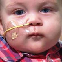 A close-up of a baby with a tube coming out of his nose.